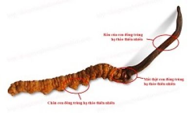 Người phụ nữ mang khối u to như thai 7 tháng