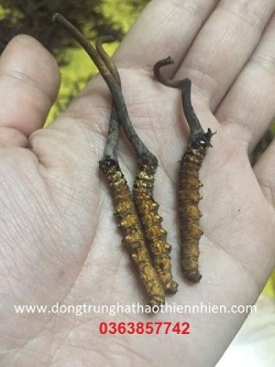 Thứ trưởng Y tế: 'Tiện nghi hiện đại khiến người Việt &iacute;t vận động hơn'