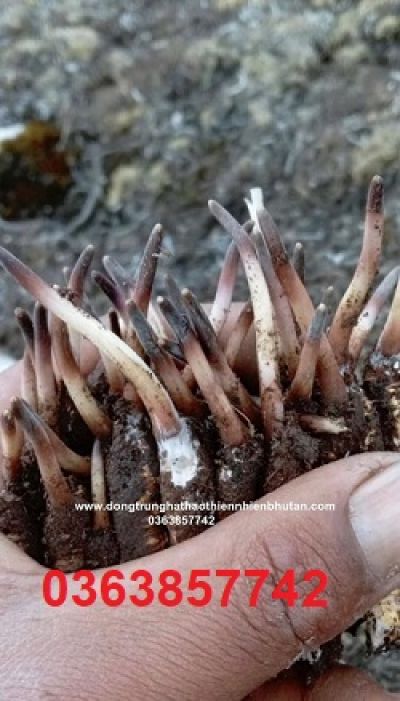 Ph&aacute;t hiện muộn - điểm nghẽn lớn nhất trong điều trị ung thư phổi