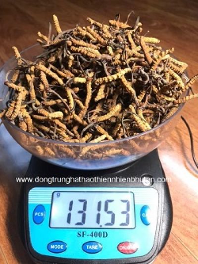 Thay khớp gối thoái hóa sau 20 năm chấn thương